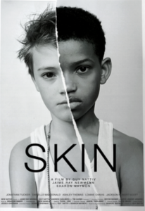 UNC English Alumnus Andrew Carlberg on his Oscar-Winning Short Film, Skin 